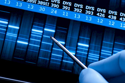 Epigenetics — When the environment controls genes